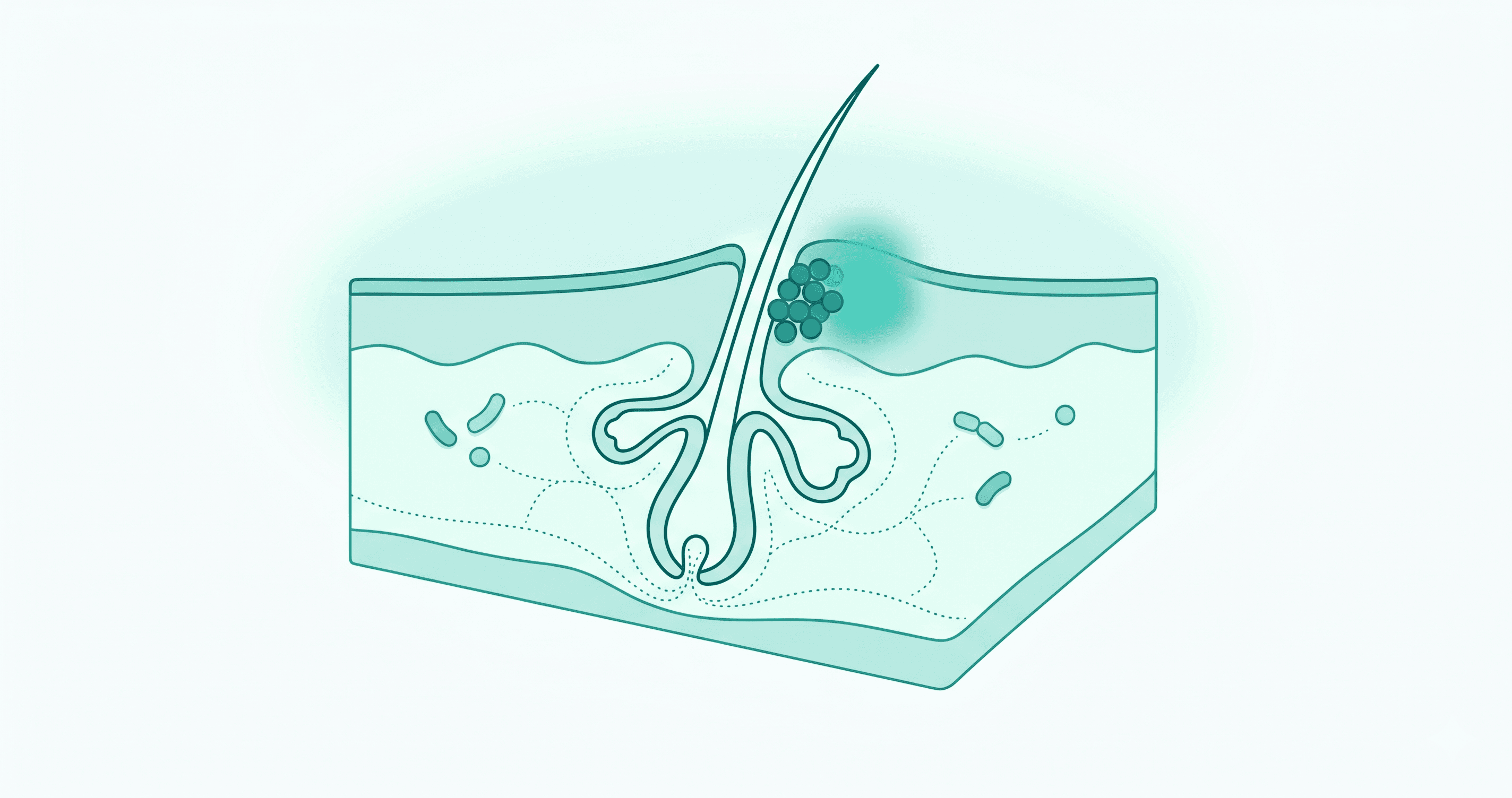 Acne and the Microbiome: What the Research Shows